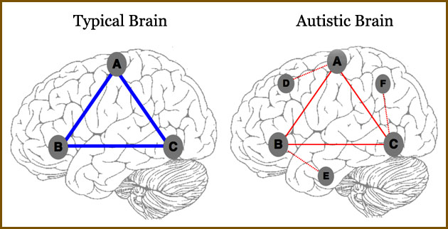 Illustration of atypical connectivity patterns observed using functional connectivity MRI. See end of story for more information about the illustration.