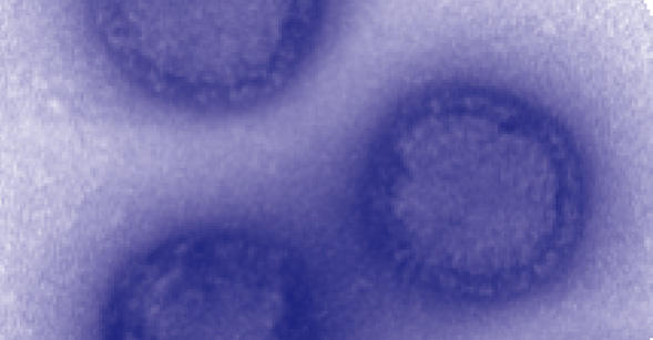 Colorized influenza A virus. Image courtesy of SDSU Electron Microscope Facility.
