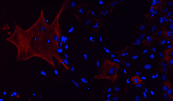 Each year, organizations around the world host events in honor of Stem Cell Awareness Day. Image courtesy of C.Kidwell.