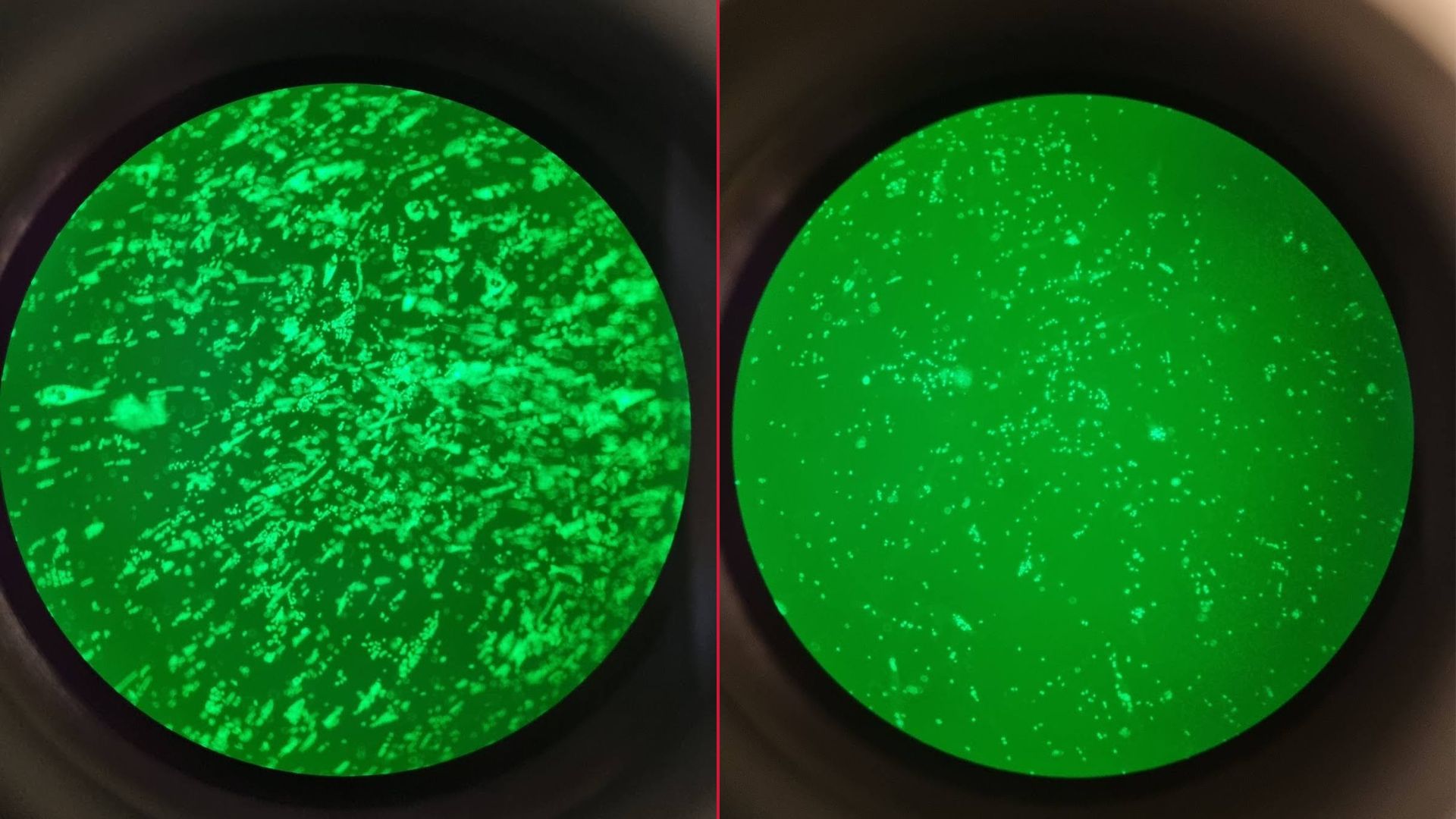 A microscope view of cells infected with fluorescent green T. cruzi parasites