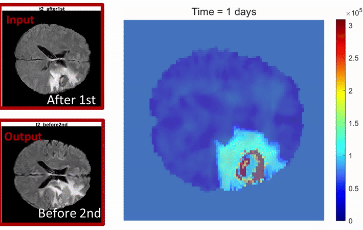 Three images of a brain scan from various stages of the study described in accompanying article.